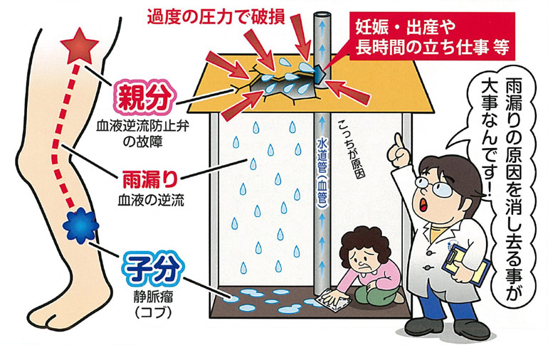 子分（コブ）を取り除くだけでは解決になりません