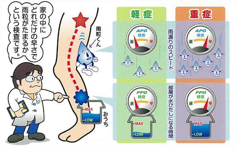 重症になる前に、お早めの検査をオススメします