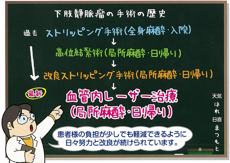 下肢静脈瘤の日帰り手術について